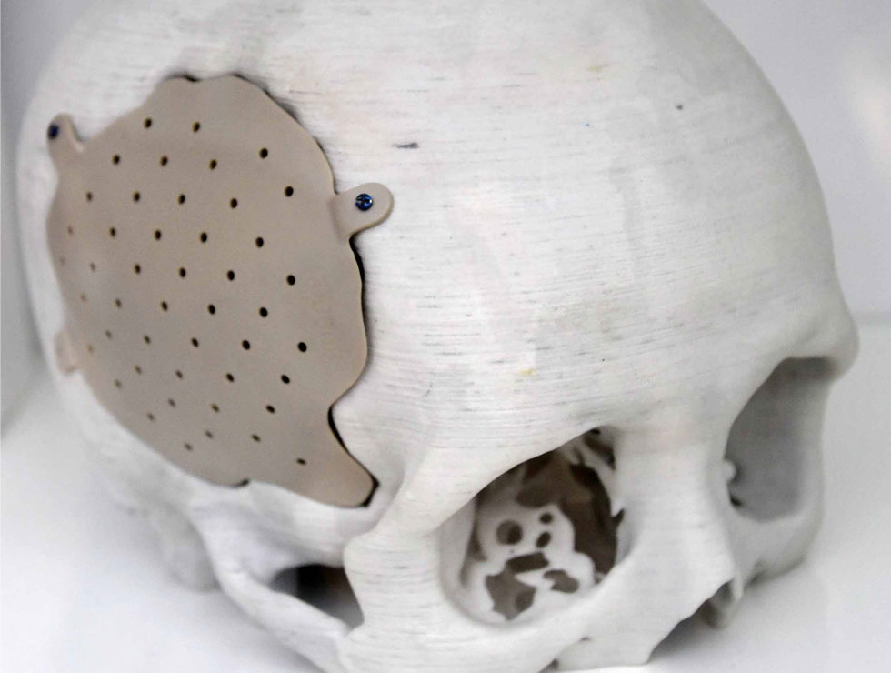 �@������ɫ�ĸ�ˎ��������Ŀ��������3D��ӡ���XĤ��